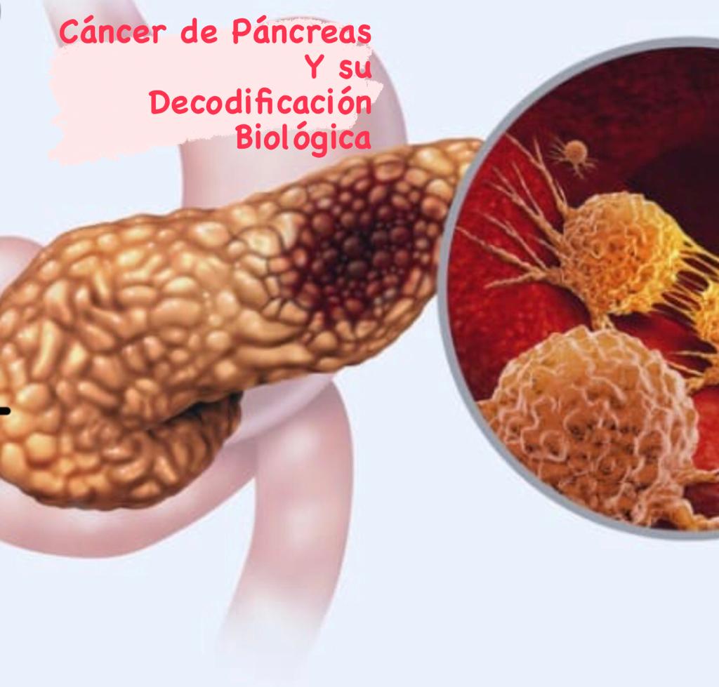 Cáncer de Pancreas y su decodificación biologica