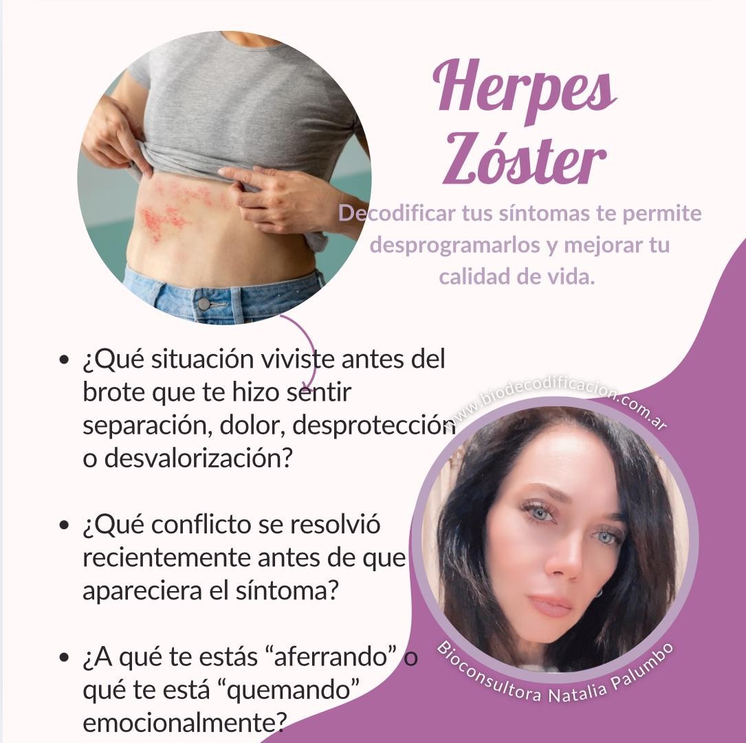 Herpes zóster
